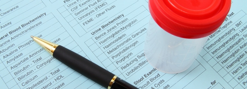 Bio sample checklist with a sample cup and pen sitting on top of it